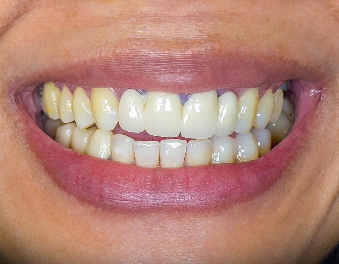 Before image