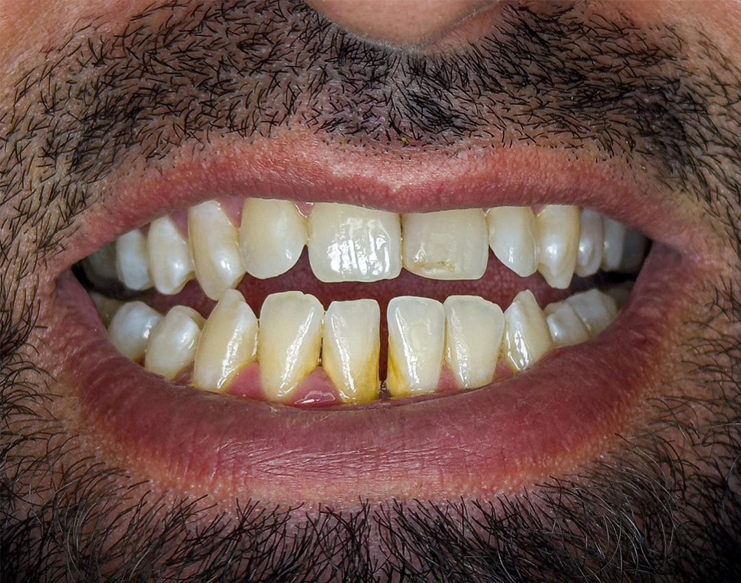 Before image