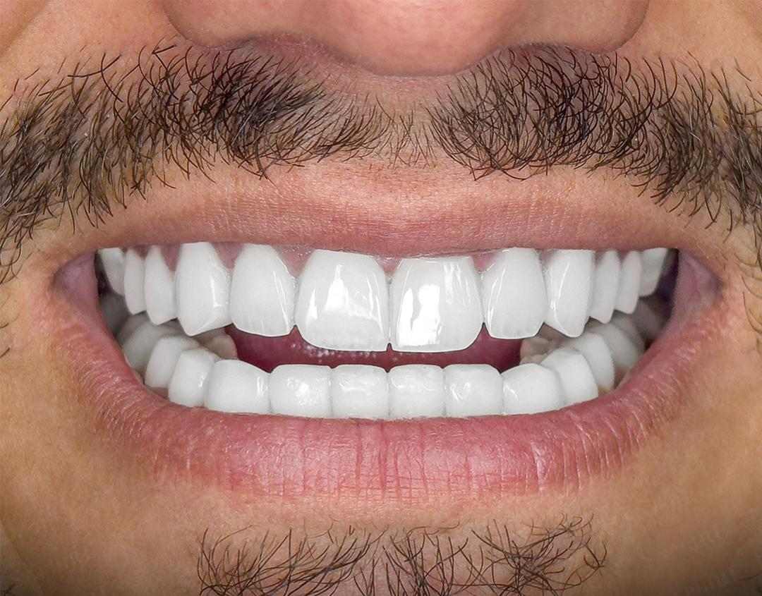 After image
