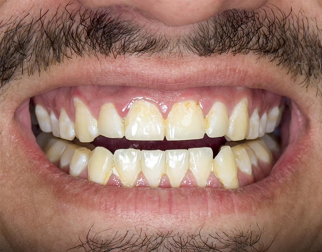 Before image