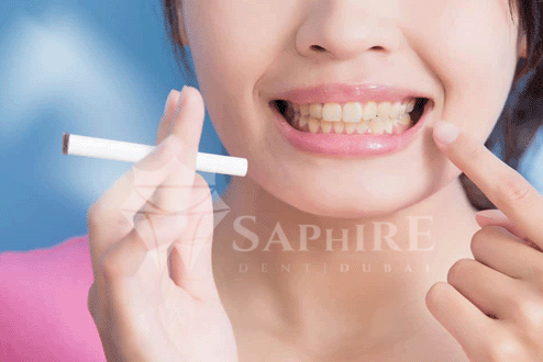 تنظيف الأسنان للمدخنين: كيف تحافظ على ابتسامة صحية في دبي