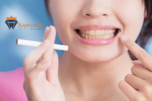 تنظيف الأسنان للمدخنين: كيف تحافظ على ابتسامة صحية في دبي