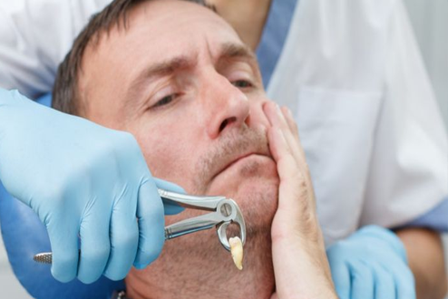 إزالة ضرس العقل والأرحاء الثالثة: من الألم إلى الراحة بخبرة وتقنيات حديثة