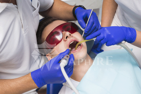 كيف يؤثر تأخير علاج العصب على صحة الأسنان؟