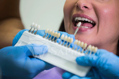 الدليل الشامل لـ زراعة الأسنان في دبي