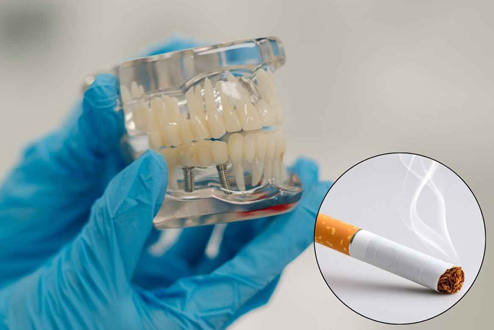 Dental Implants for Smokers: Is It Still Possible?