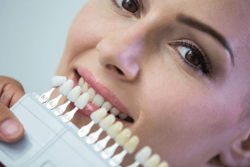 زراعة الأسنان في يوم واحد… خبرة الأطباء تلتقي بأحدث التقنيات