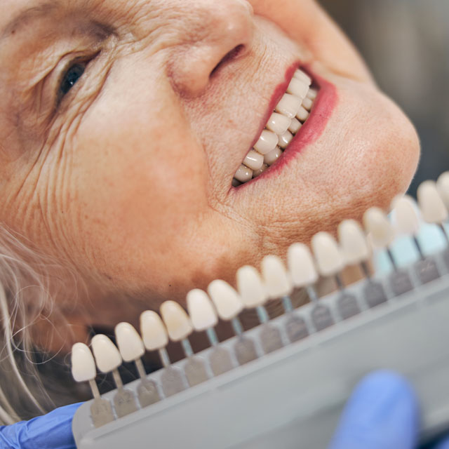Dental Crowns