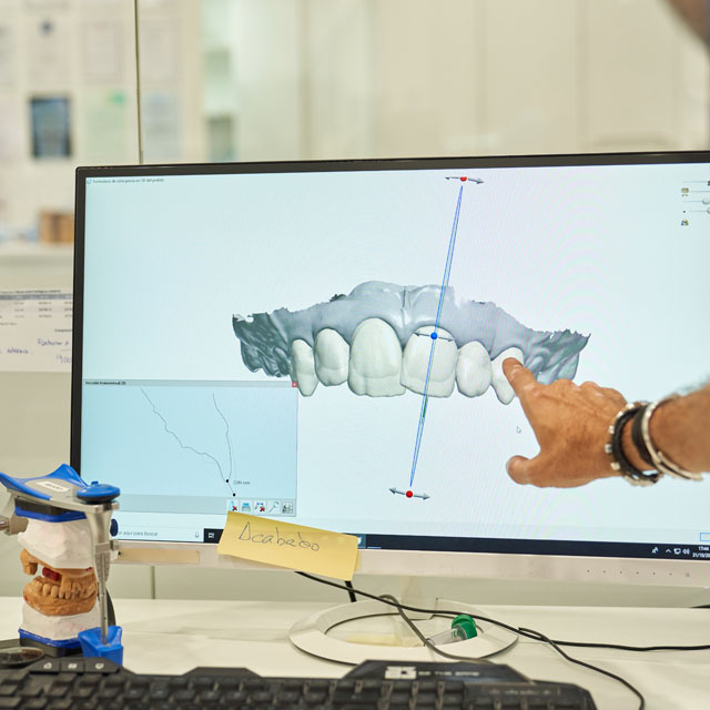 Digital Smile Design