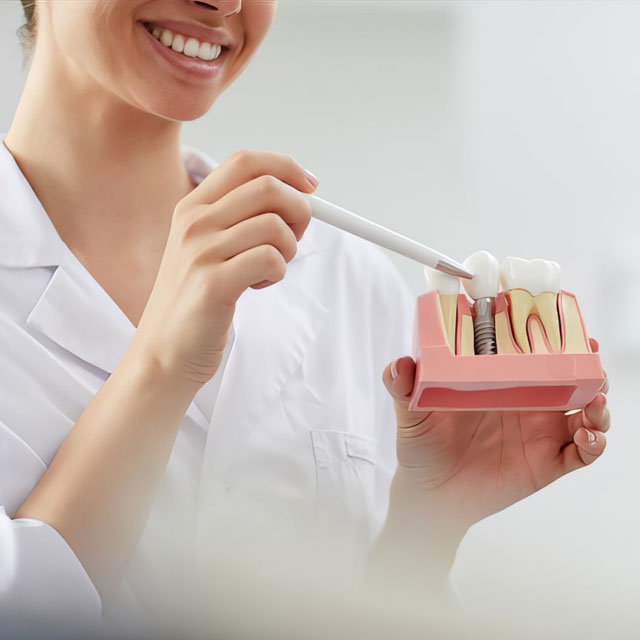 Immediate Loading Implants (same-day teeth)