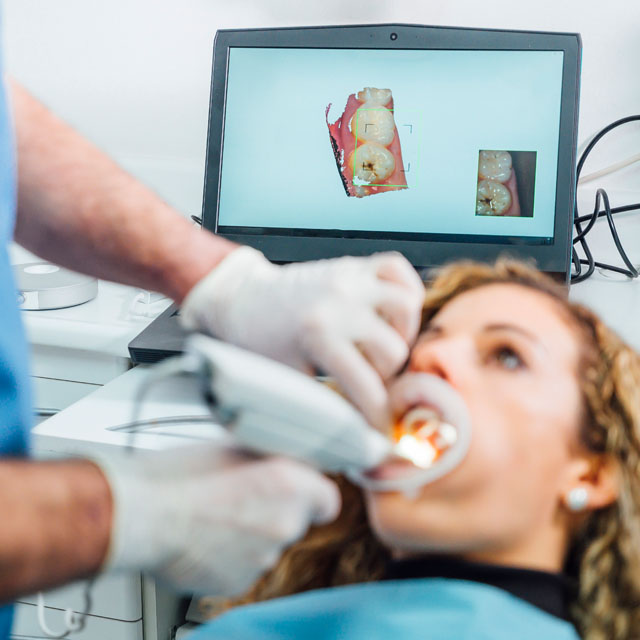 Intraoral Scanning