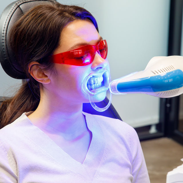 Laser-Assisted RCT